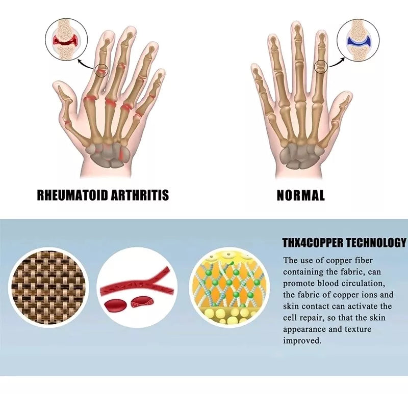 ARTIGLOV™ Guantes Compresión Para Tunel Carpiano y artritis